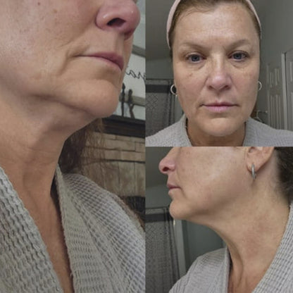 FaceDR - kit 2 Escovas de Drenagem Linfática Facial [PAGUE 1 LEVE2]