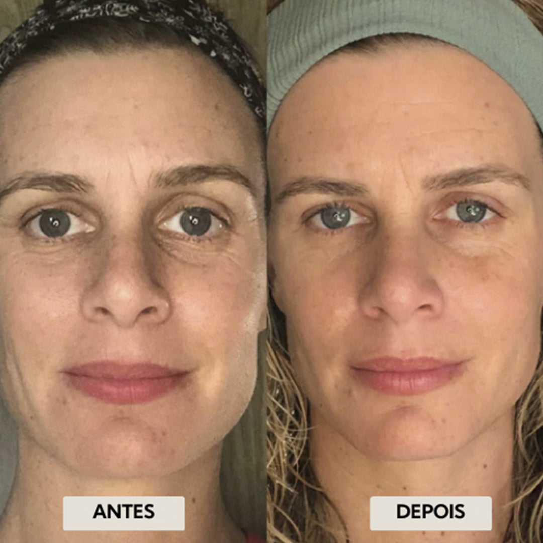 FaceDR - kit 2 Escovas de Drenagem Linfática Facial [PAGUE 1 LEVE2]