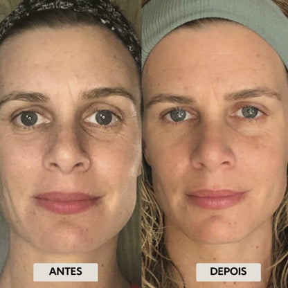 FaceDR - kit 2 Escovas de Drenagem Linfática Facial [PAGUE 1 LEVE2]